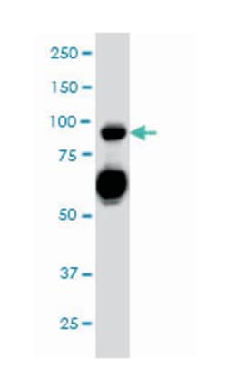 sema domain, immunoglobulin domain (Ig), transmembrane domain (TM) and