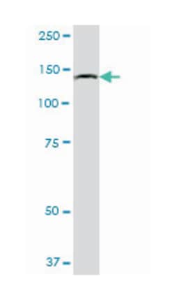 hypoxia up-regulated 1, Mouse, Purified MaxPab Polyclonal Antibody, Abnova 50 &mu;g | Buy Online | Abnova Corporation | Fisher Scientific