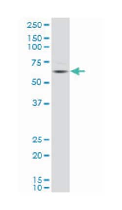 dihydropyrimidinase-like 4, Mouse, Polyclonal Antibody, Abnova™