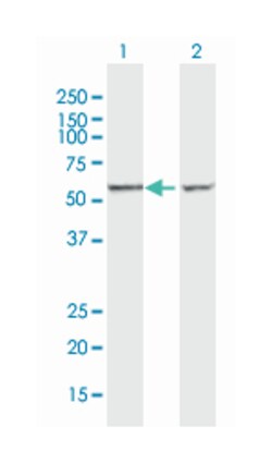 CCT7, Mouse, Polyclonal Antibody, Abnova 50&mu;g; Unlabeled:Antibodies,