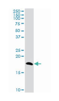 Niemann-Pick disease, type C2, Mouse, Purified MaxPab Polyclonal Antibody, Abnova 50 &mu;g | Buy Online | Abnova Corporation | Fisher Scientific
