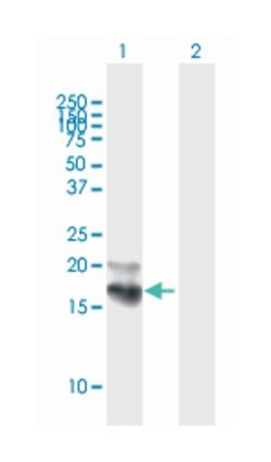Niemann-Pick disease, type C2, Mouse, Purified MaxPab Polyclonal Antibody, Abnova 50 &mu;g | Buy Online | Abnova Corporation | Fisher Scientific