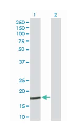 NPC2, Rabbit, Purified MaxPab Polyclonal Antibody, Abnova 100&mu;g; Unlabeled:Antibodies,