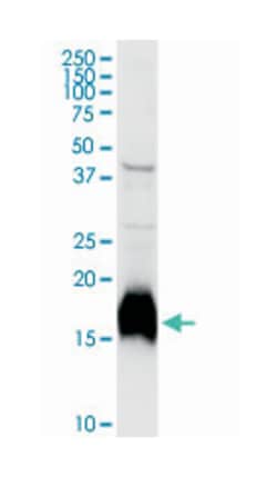 NPC2, Rabbit, Purified MaxPab Polyclonal Antibody, Abnova 100&mu;g; Unlabeled:Antibodies,