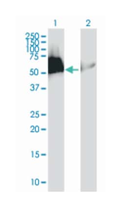 hexamethylene bis-acetamide inducible 1 (B01), Mouse anti-Human, Polyclonal