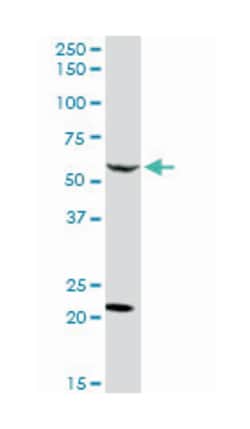calcium/calmodulin-dependent protein kinase kinase 2, beta, Rabbit, Purified MaxPab™ Polyclonal Antibody, Abnova™