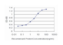calcium/calmodulin-dependent protein kinase kinase 2, beta, Mouse, Clone: