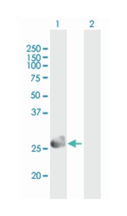 SPINT2, Mouse, Polyclonal Antibody, Abnova 50&mu;g; Unlabeled:Anticuerpos