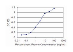 CSPG5, Mouse, Clone: 4G6, Abnova 100 &mu;g | Buy Online | Abnova | Fisher Scientific