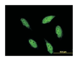 T-box, brain, 1, Mouse, Clone: 3F6, Abnova 100&mu;g; Unlabeled:Antibodies,