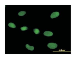 ribonuclease P/MRP 40kDa subunit, Mouse, Polyclonal Antibody, Abnova 50&mu;L;