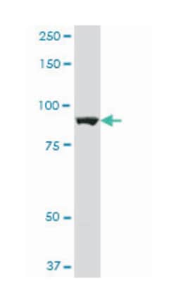 aldehyde dehydrogenase 1 family, member L1, Mouse, Polyclonal Antibody, Abnova 50 &mu;L | Buy Online | Abnova Corporation | Fisher Scientific