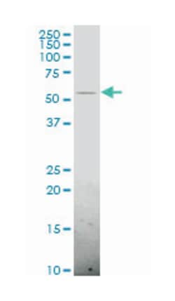 CD3e molecule, epsilon associated protein, Mouse, Polyclonal Antibody,