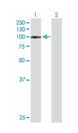 leukocyte immunoglobulin-like receptor, subfamily B (with TM and ITIM domains),