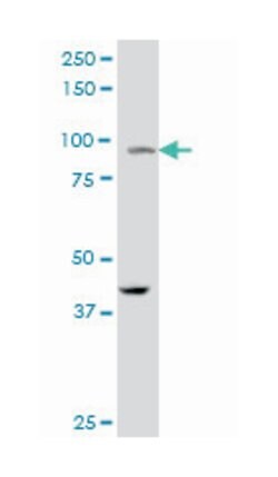 peroxisome proliferator-activated receptor gamma, coactivator 1 alpha,