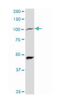 peroxisome proliferator-activated receptor gamma, coactivator 1 alpha,