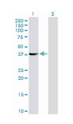 SGT1, suppressor of G2 allele of SKP1 (S. cerevisiae), Rabbit, Purified