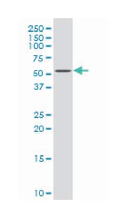 ectodysplasin A receptor, Mouse, Polyclonal Antibody, Abnova™