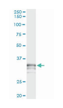 protease, serine, 21 (testisin), Mouse, Clone: 2E10, Abnova 100&mu;g; Unlabeled:Antibodies,