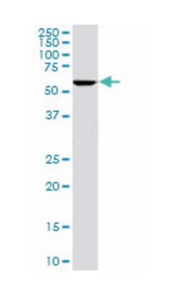 stress-induced-phosphoprotein 1, Mouse, Clone: 1E3, Abnova 100&mu;g; Unlabeled:Antibodies,