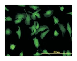 stress-induced-phosphoprotein 1, Mouse, Clone: 1E3, Abnova 100&mu;g; Unlabeled:Antibodies,