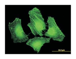 fermitin family homolog 2 (Drosophila), Mouse, Clone: 2G11, Abnova 100&mu;g;