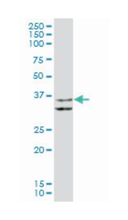 microtubule-associated protein, RP/EB family, member 2 (B02), Mouse anti-Human,