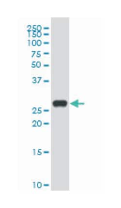 GLI pathogenesis-related 1, Mouse, Polyclonal Antibody, Abnova&trade;