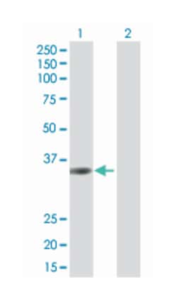 transmembrane protein 115, Mouse, Polyclonal Antibody, Abnova 50 &mu;L | Buy Online | Abnova Corporation | Fisher Scientific