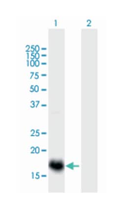ESM1 (B01), Mouse anti-Human, Polyclonal Antibody, Abnova 50&mu;L; Unlabeled:Antibodies,