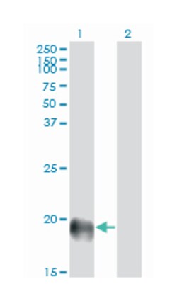endothelial cell-specific molecule 1, Mouse, Clone: 6D4, Abnova 100&mu;g;