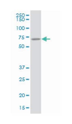 arginyltransferase 1 (A01), Mouse anti-Human, Polyclonal Antibody, Abnova™