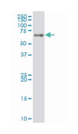 leucine zipper, putative tumor suppressor 1, Mouse, Polyclonal Antibody, Abnova 50 &mu;L | Buy Online | Abnova Corporation | Fisher Scientific