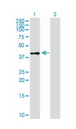 WNT inhibitory factor 1, Mouse, Purified MaxPab Polyclonal Antibody, Abnova 50 &mu;g | Buy Online | Abnova | Fisher Scientific