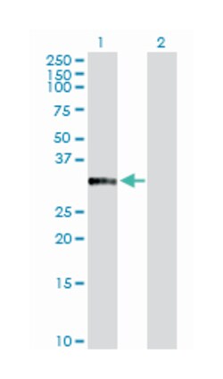 annexin A10, Rabbit, Purified MaxPab Polyclonal Antibody, Abnova 100&mu;g;