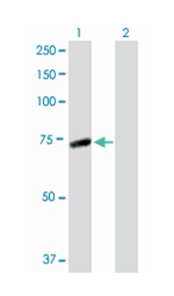interleukin-1 receptor-associated kinase 3, Rabbit, Purified MaxPab Polyclonal
