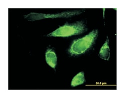 polymerase (DNA directed), gamma 2, accessory subunit, Mouse, Purified