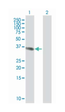 ubiquitin specific peptidase 18 (B01), Mouse anti-Human, Polyclonal Antibody,