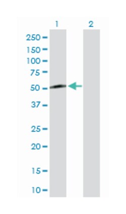 Kruppel-like factor 8, Rabbit, Purified MaxPab Polyclonal Antibody, Abnova