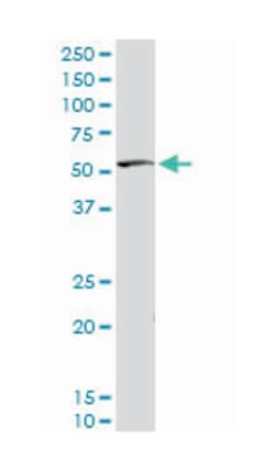 serine/threonine kinase 38, Rabbit, Purified MaxPab Polyclonal Antibody,