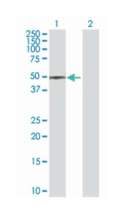 serine/threonine kinase 38, Rabbit, Purified MaxPab Polyclonal Antibody,