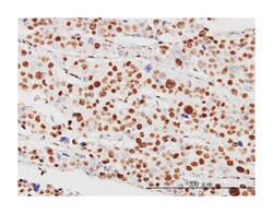 serine/threonine kinase 38, Mouse, Clone: 2G8-1F3, Abnova 100&mu;g; Unlabeled:Antibodies,