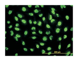 serine/threonine kinase 38, Mouse, Clone: 2G8-1F3, Abnova 100&mu;g; Unlabeled:Antibodies,