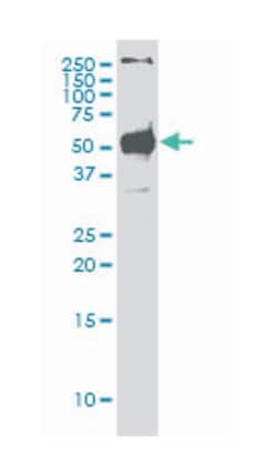 STK38, Mouse, Clone: 2G8-1F3, Abnova 200&mu;L; Unlabeled:Antibodies, Monoclonal