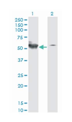 STK38, Mouse, Clone: 2G8-1F3, Abnova 200&mu;L; Unlabeled:Antibodies, Monoclonal