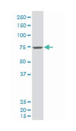 cancer susceptibility candidate 3, Mouse, Polyclonal Antibody, Abnova 50&mu;L;
