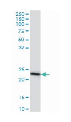 RRAS2, Mouse, Clone: 2D3-4B8, Abnova 200 &mu;L | Buy Online | Abnova Corporation | Fisher Scientific