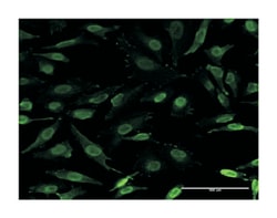 IKAROS family zinc finger 3 (Aiolos), Mouse, Clone: 3H5-G7, Abnova 100&mu;g;