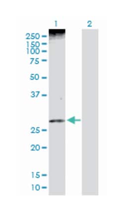 pleckstrin homology-like domain, family A, member 1, Rabbit, Purified MaxPab