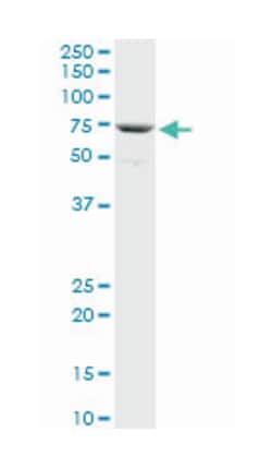 RHOBTB3, Mouse, Polyclonal Antibody, Abnova 50 &mu;L | Buy Online | Abnova Corporation | Fisher Scientific